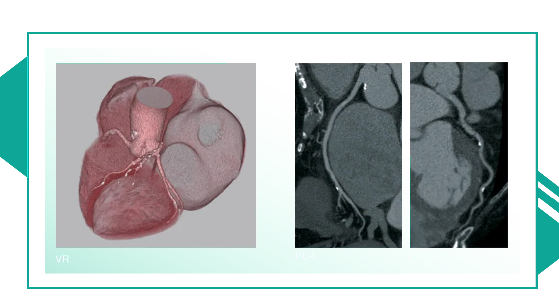 Cardiac CT image 5