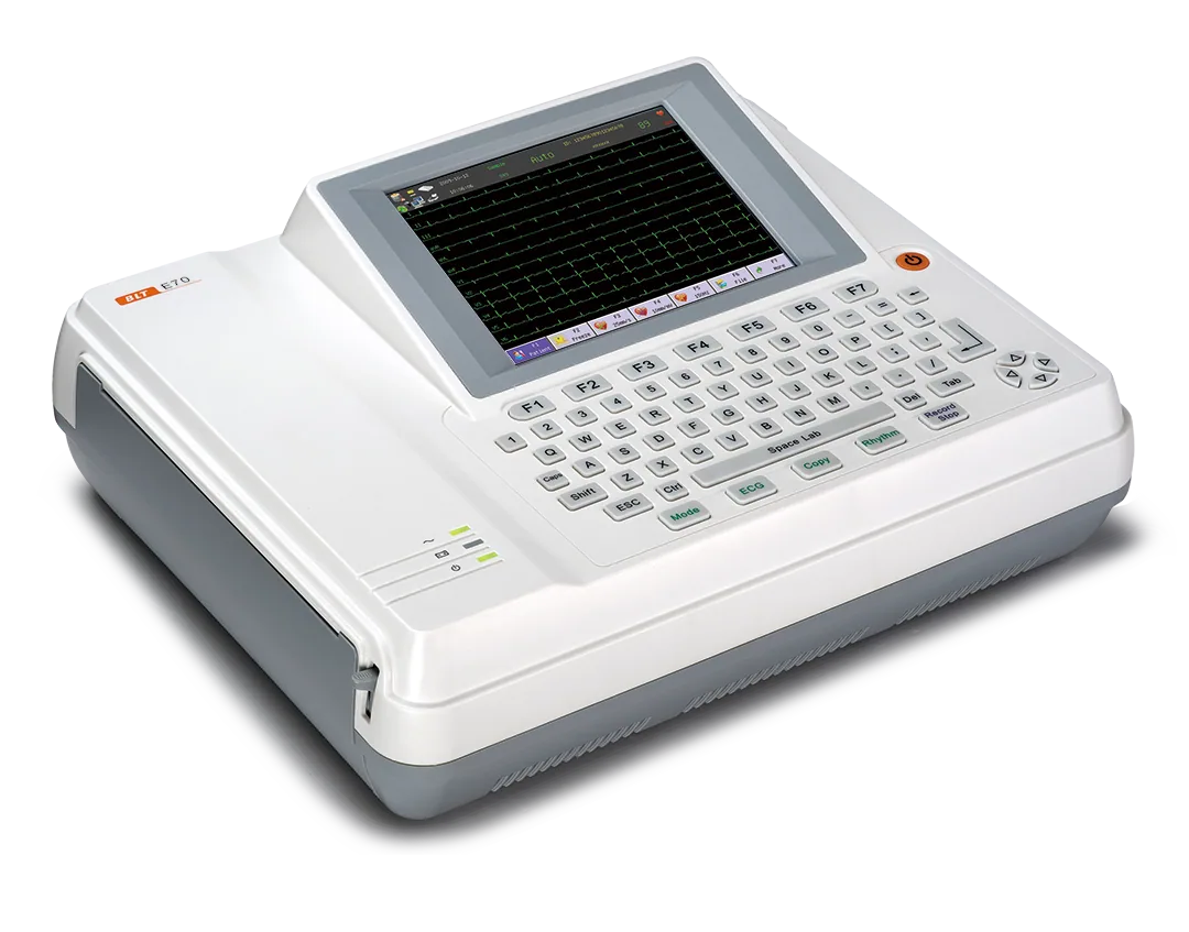 ECG image 2
