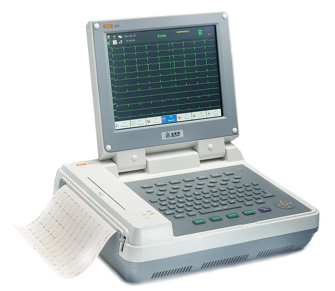 ECG image 4