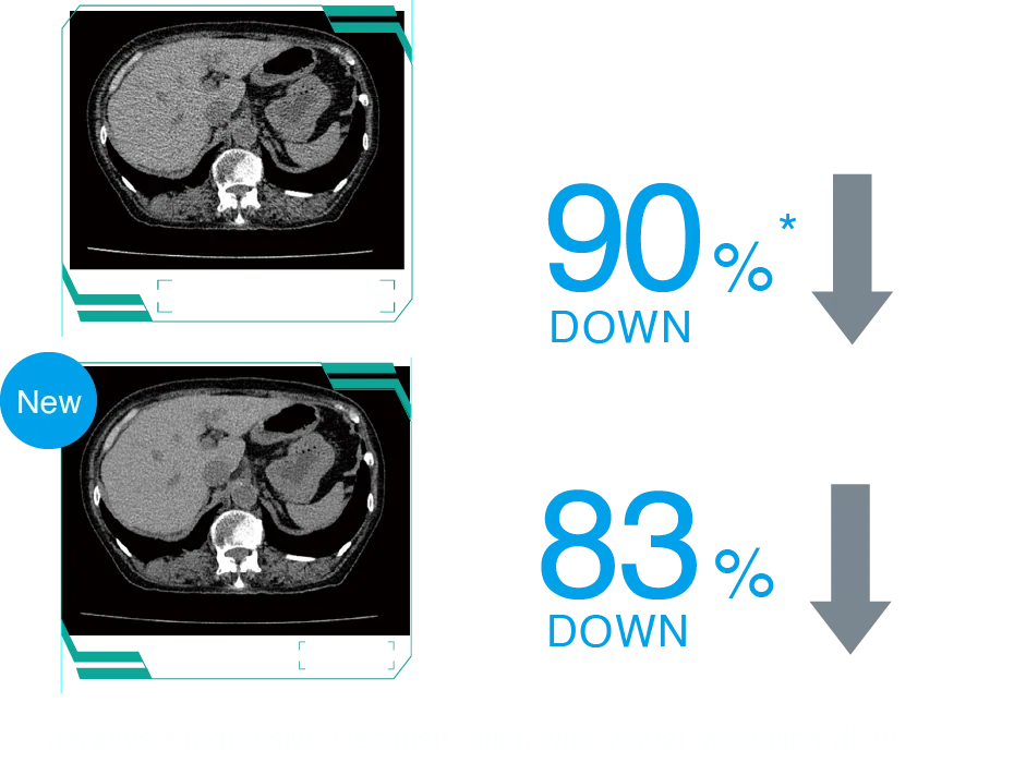 Cardiac CT image 2
