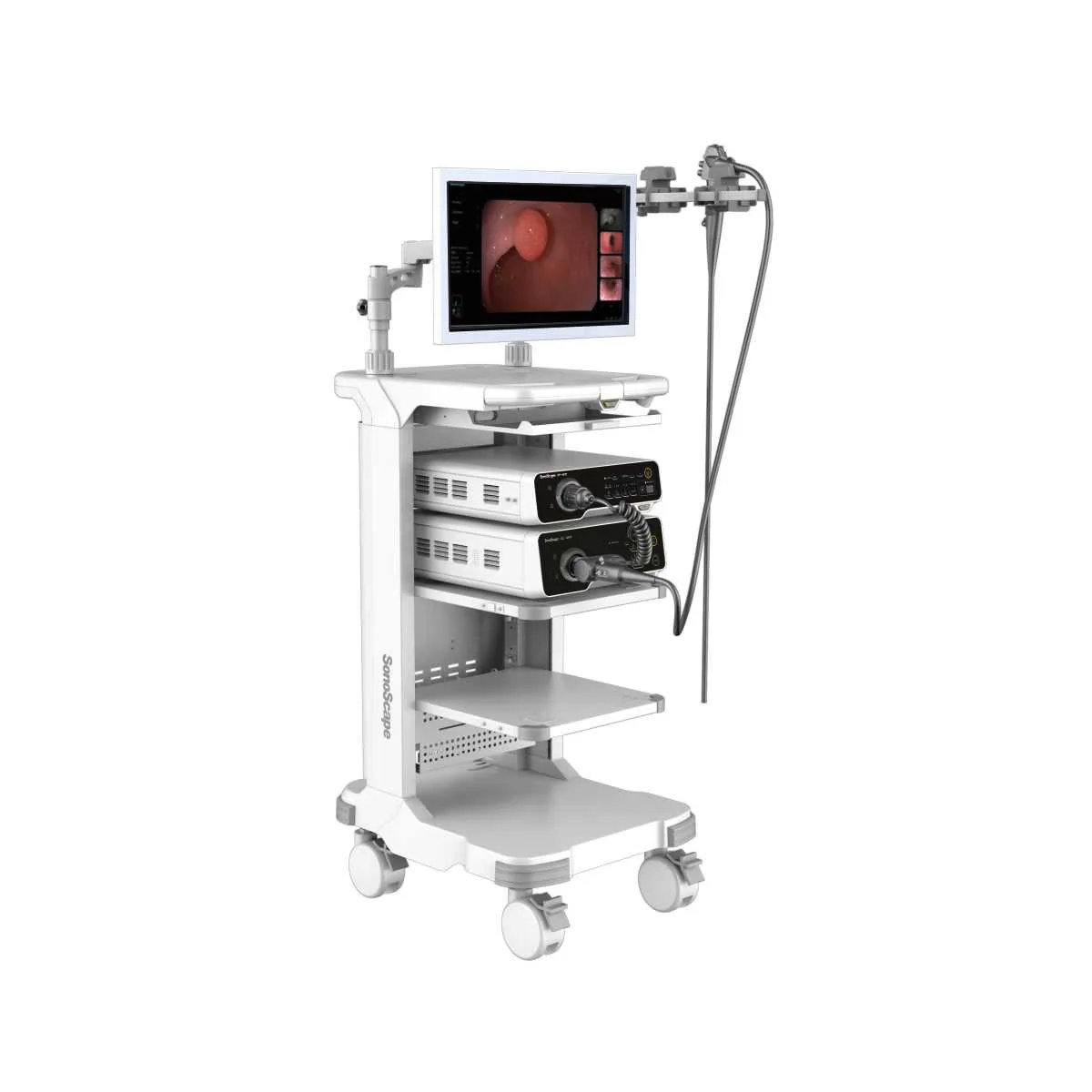 Endoscopy
